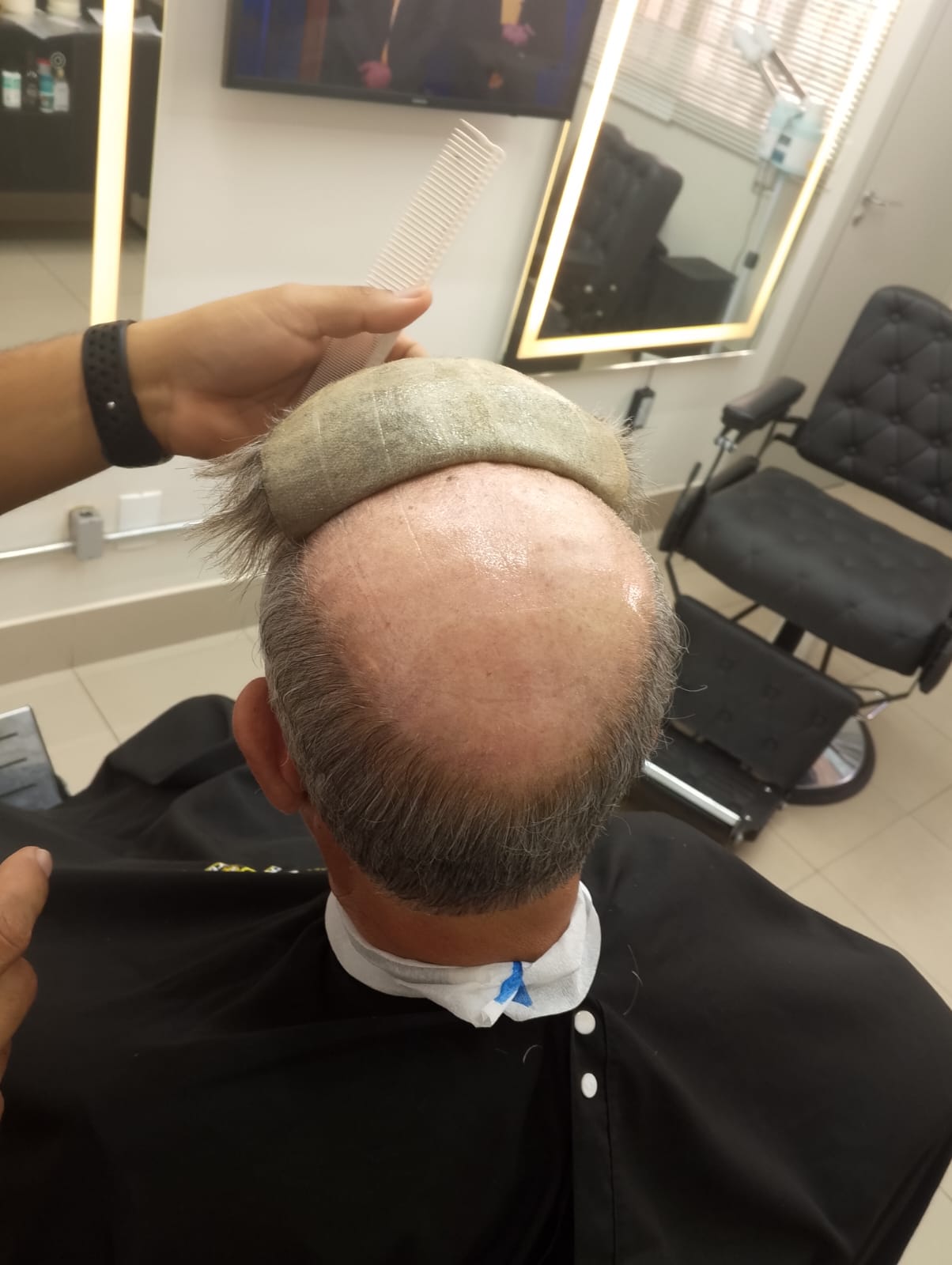 Tratamentos - Tintura e Botox
